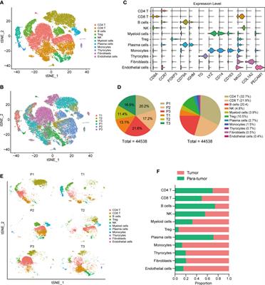 Integrated analysis of fibroblasts molecular features in papillary thyroid cancer combining single-cell and bulk RNA sequencing technology